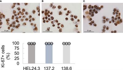 Generation and Characterization of iPS Cells Derived from APECED Patients for Gene Correction
